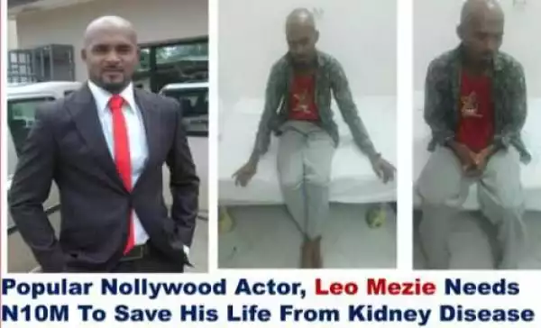 Actor Leo Mezie loses use of right leg - Fund raising campaign still OPEN